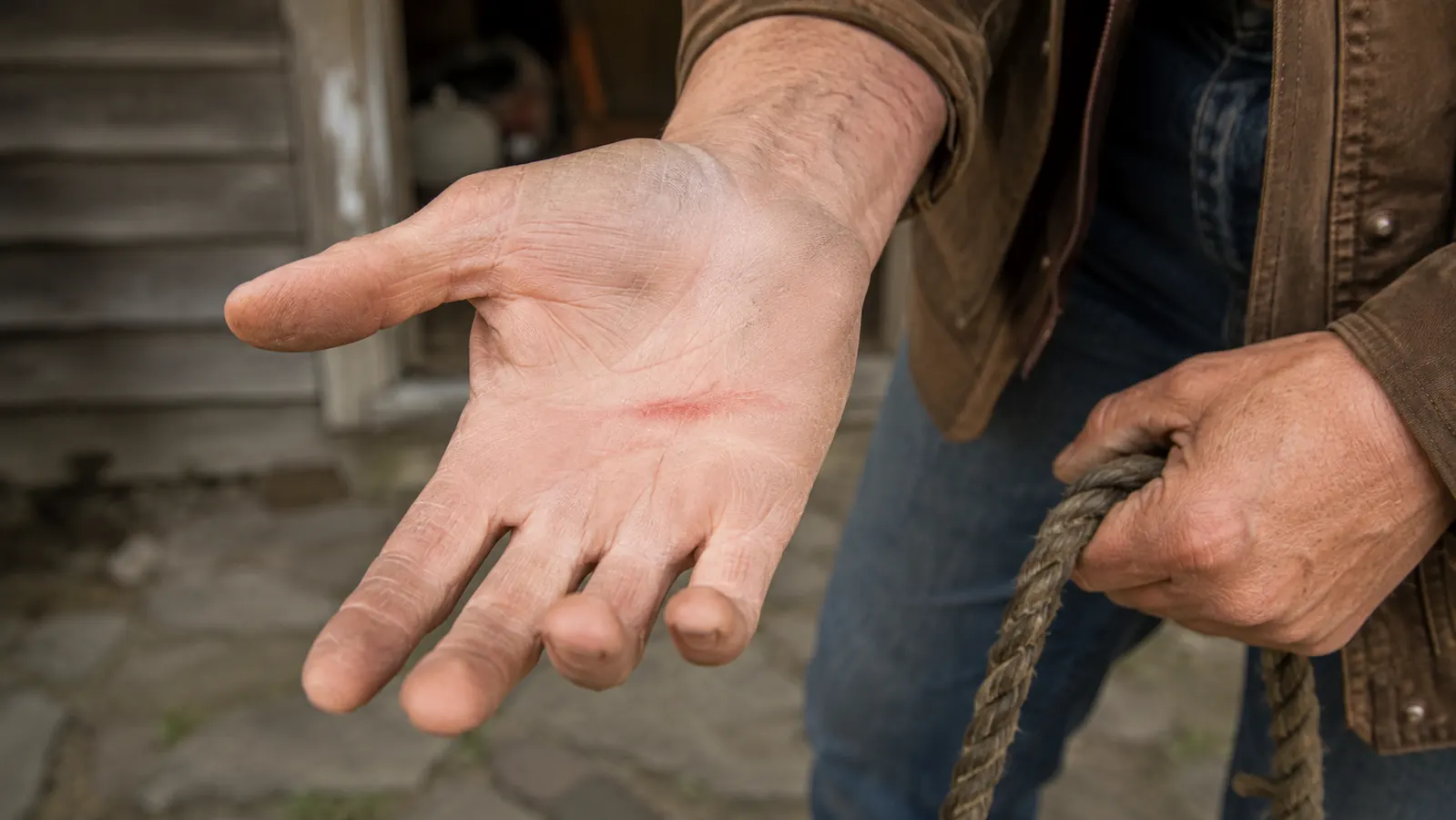 Close-up of a bare palm with a faint red line mark across it from rope friction